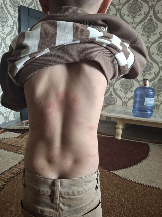 Dezinfeksiya Navoiy 24/7 — Kafolatli Litsenziya bor