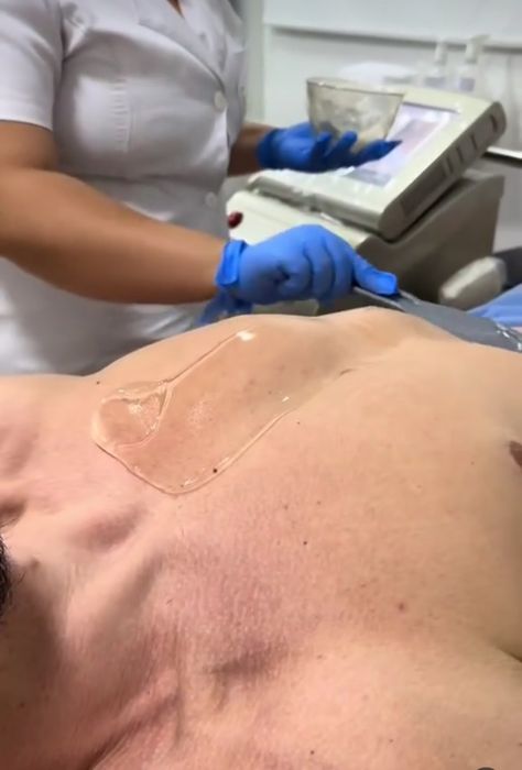 Лазерный епилатция и депилатсия для мужчина