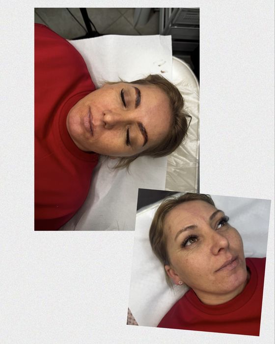 Laminare la sprancene