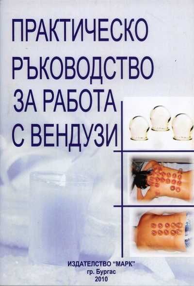 Практическо ръководство за работа с вендузи