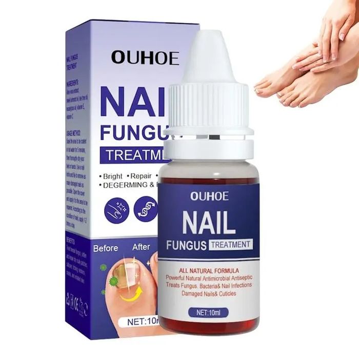 Препарат за гъбички по ноктите