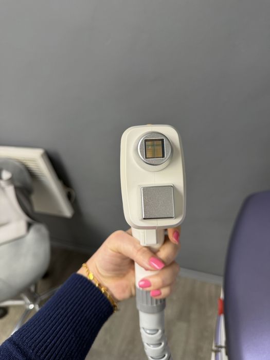 Доиодна лазерна епилация