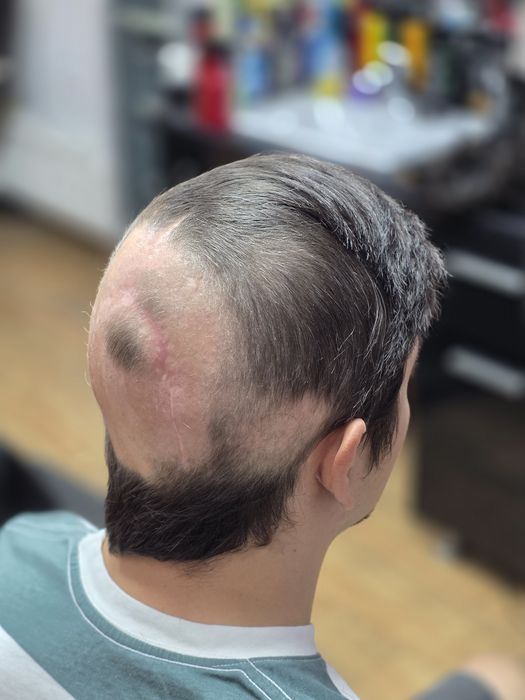 Top hair system barbati