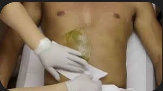 Депеляция для мужчин и женщин