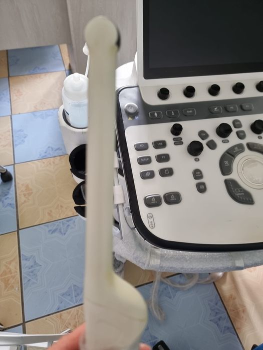 Узи аппарат Chison