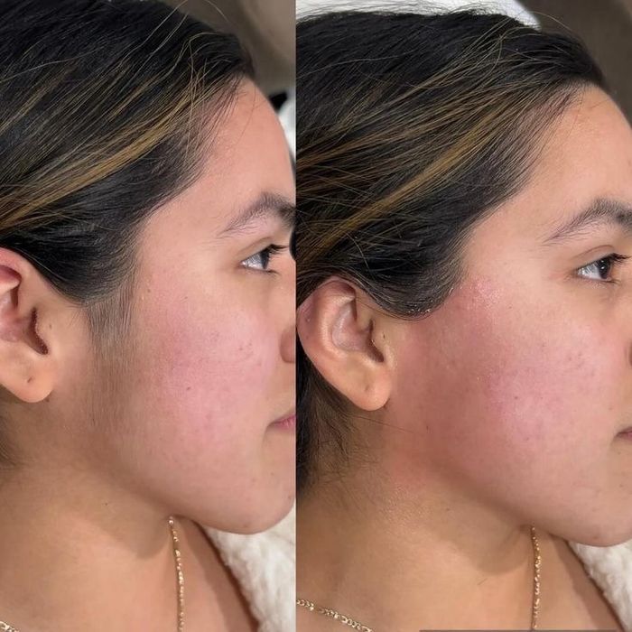 Ламинация и депиляция