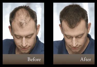 Оргинални Made in USA Кератинови фибри за коса Топпик/Козметика 27.5гр