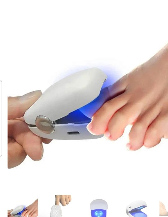 Лазерно лечение на гъбички по ноктите