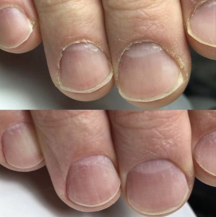 Мужской педикюр от А до Я