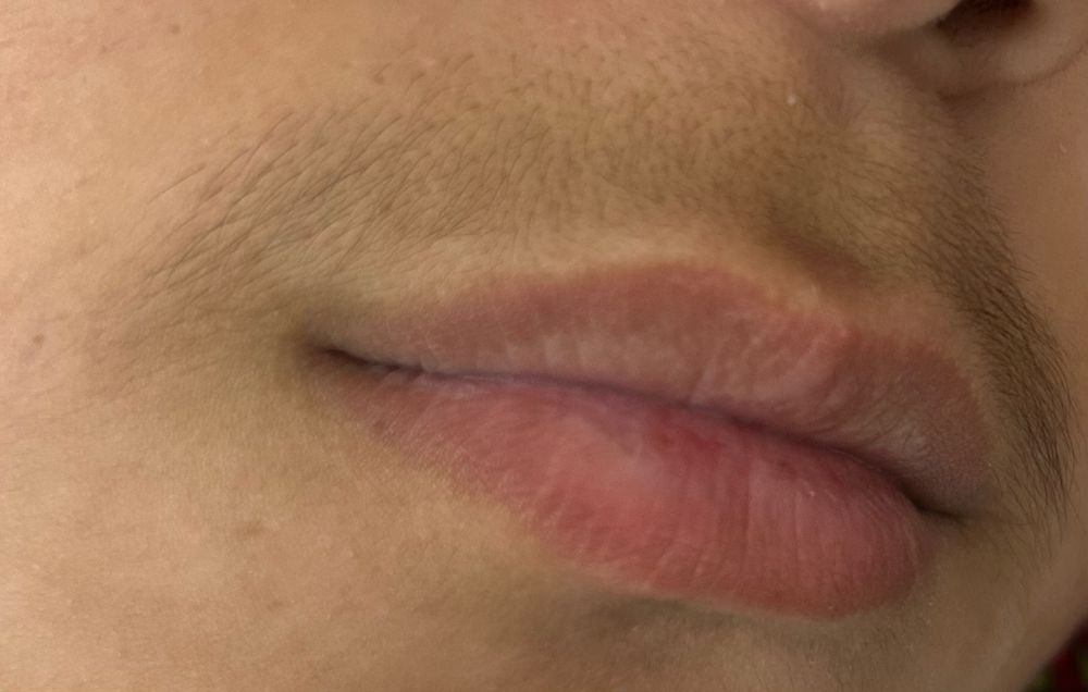 Шугаринг сахар~воск.