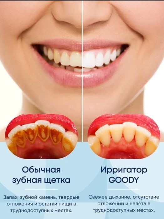 Ирригатор  8 насадок