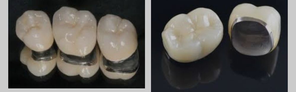 Servicii de stomatologie de calitate la preturi accesibileOferte !!!