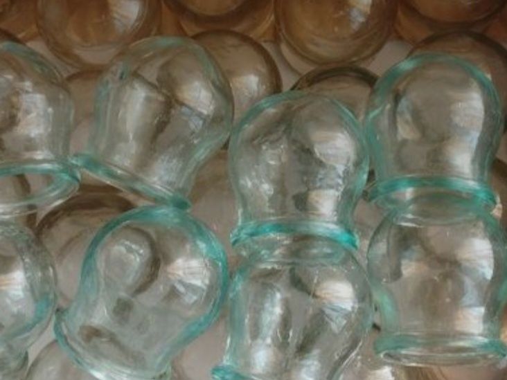 Банки медицинские