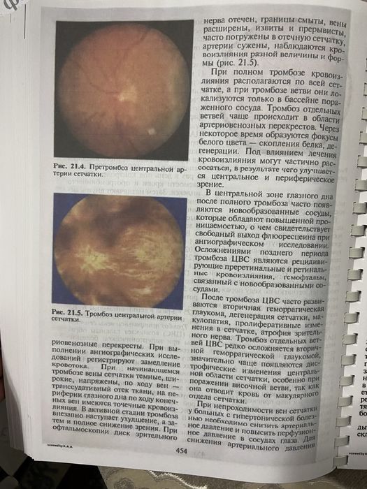 Глазные болезни Копаева