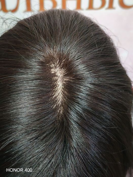 Макушку из натуральных волос