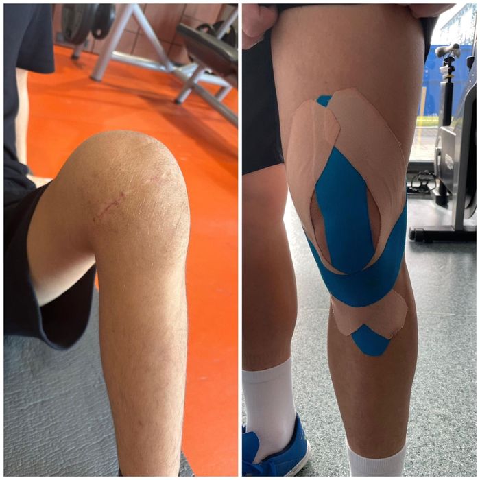 Kinetoterapie la domiciliu