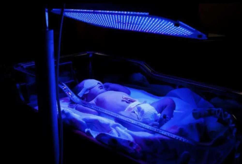 FOTOLAMPA  Yangi tug'ilgan chaqaloqlar uchun