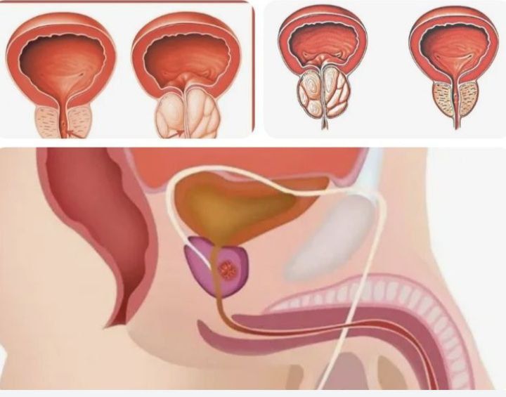 Молодой парень массажист. Урологический массаж. Лечение простаты.