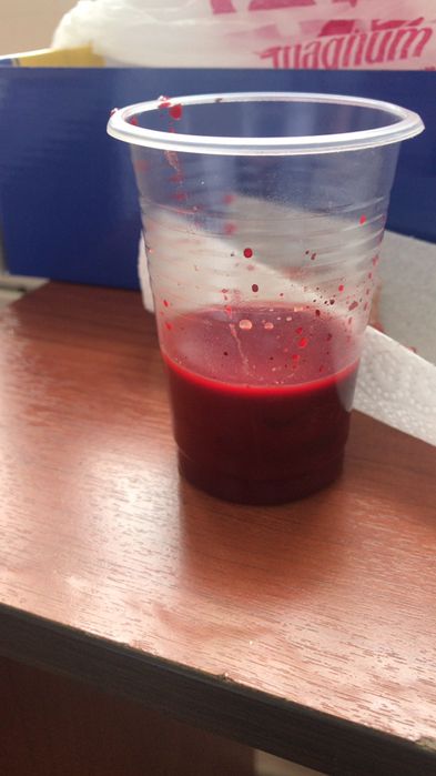 Банки Хиджамы 5тыс  Лезвие 5000тг