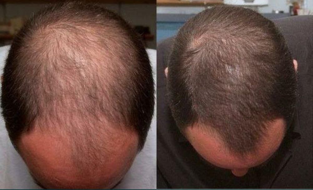 soch-soqol o'stiradigan orginali 100% o'stiradi Namangan