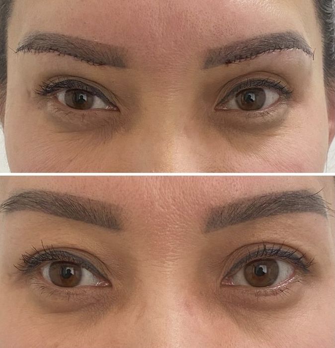 Броулифтинг со скидкой