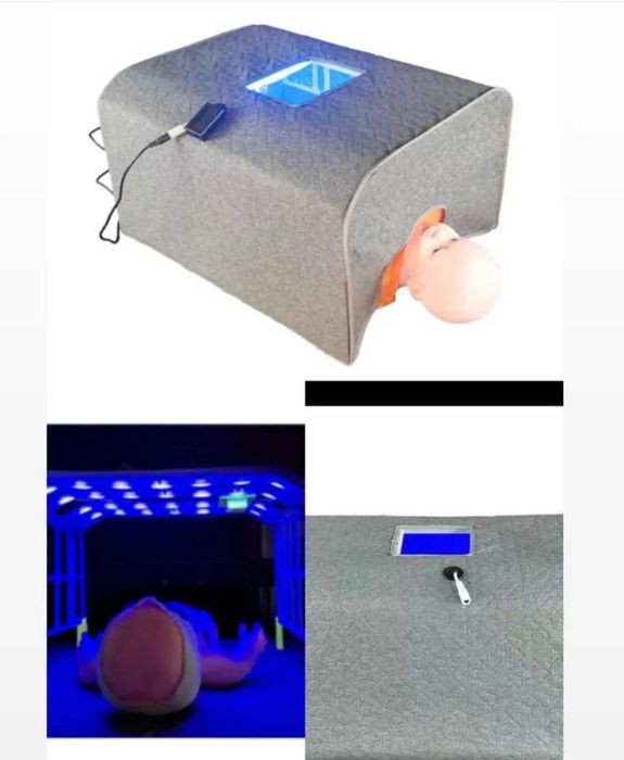 Фотолампа от желтухи