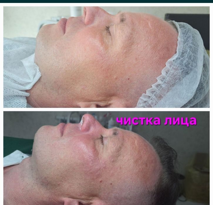 Депиляция г. АЛМАТЫ