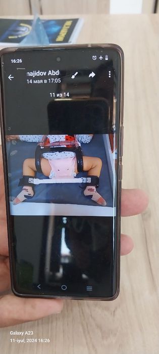 Egar shina holati yengide