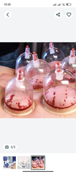 Массаж аеллар ва болалар