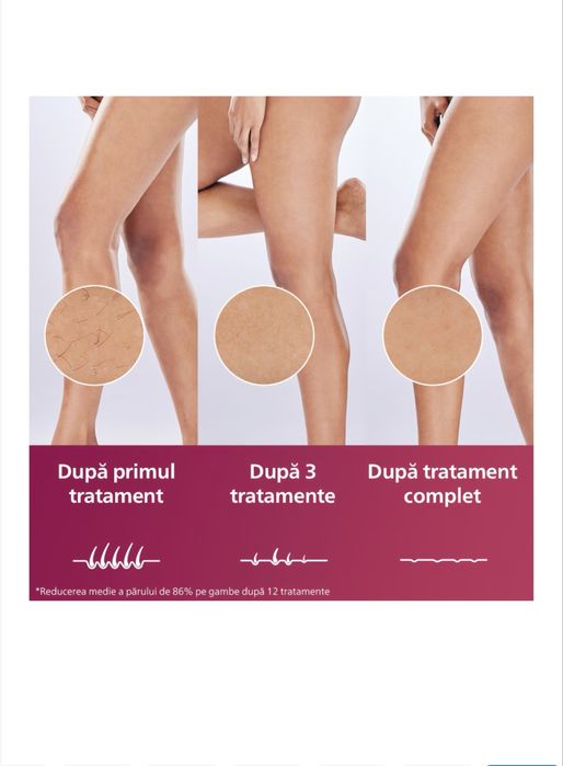 Epilator Philips Lumea Advanced,, nou