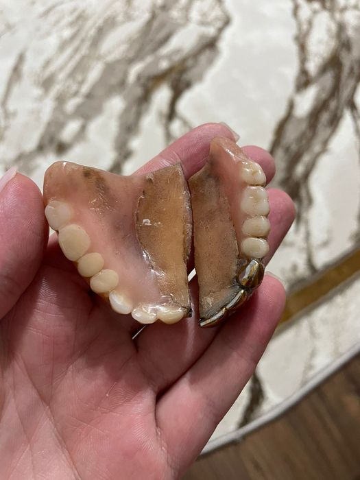 Протез починю своими руками