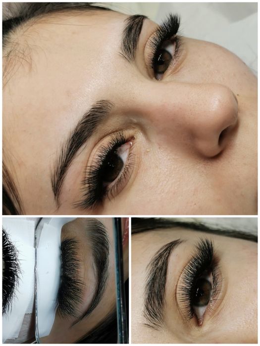 Extensii de gene 1-5D