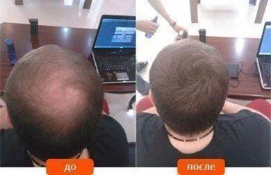 Средство для маскировки залысин