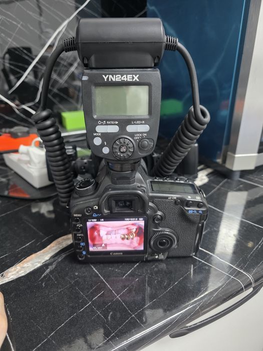Фотоаппарат Canon стоматологический
