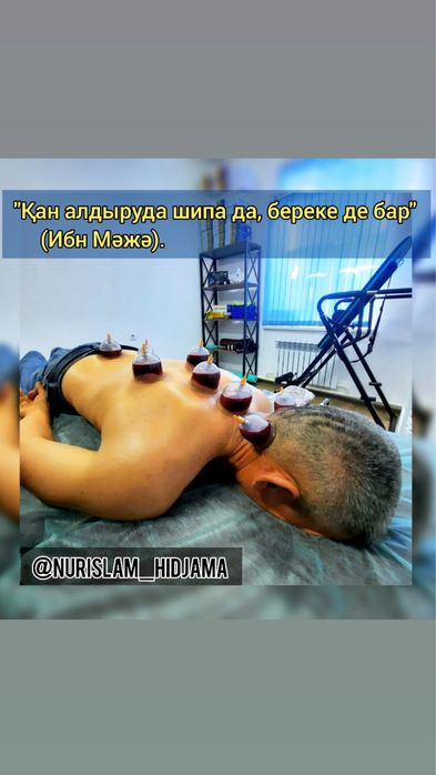 Алматы Хиджаманың барлық түрі