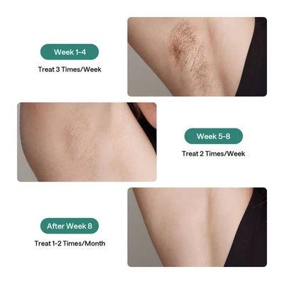 Ulike Air 2 IPL епилатор с охлаждаща технология, за тяло и лице, захра