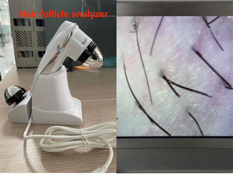 Диодна лазерна машина