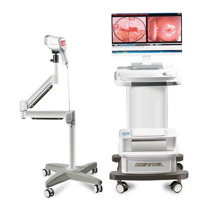 Видеоколпоскопа