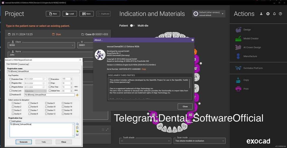 Exocad 3.2, Real guide 5.4, 3Shape 2024 Unite