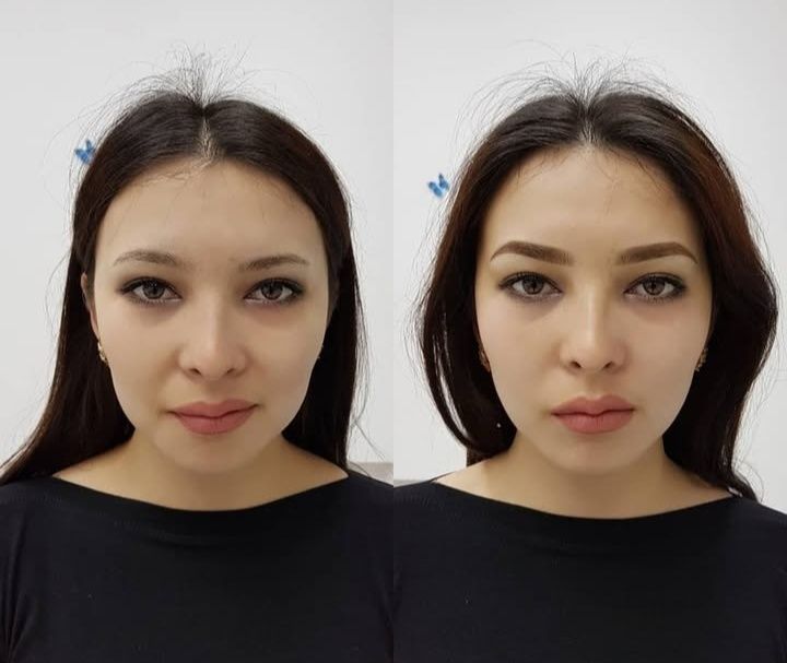 Информация для женщин.