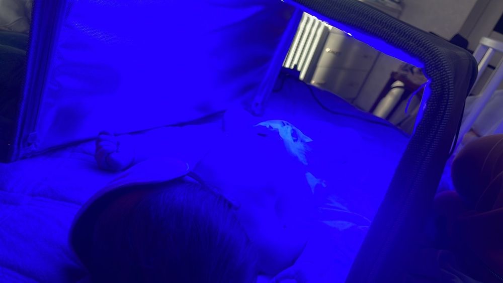 Аренда лампы от желтухи