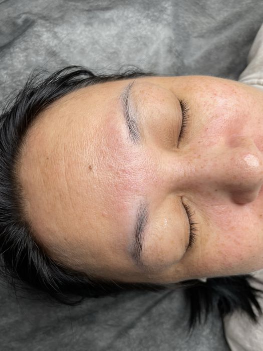 Удаление тату и татуажа