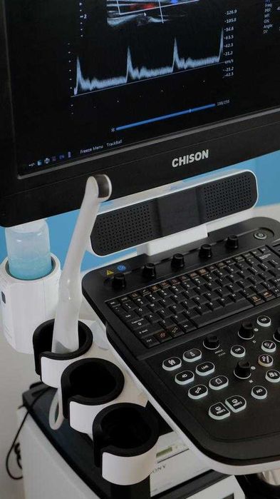 УЗИ аппарат Chison QBit 7