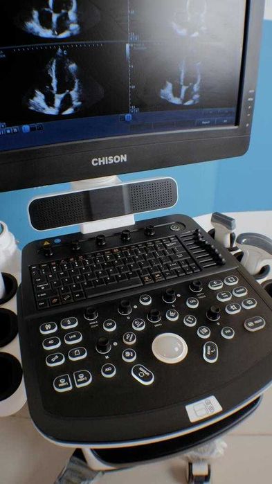 УЗИ аппарат Chison QBit 7