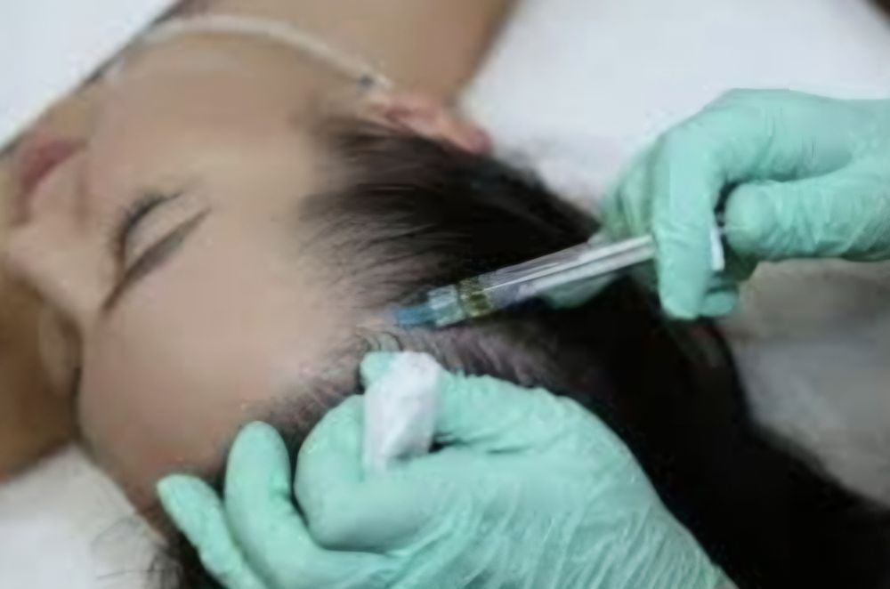 Plazmalifting,yuzga va soch tùkilishiga, Плазмалифтинг