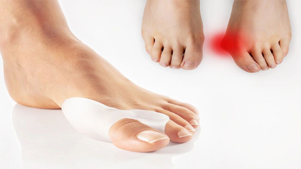 Valgus shina silekon, валгус шина силекон, Hallux valgus, комфорт