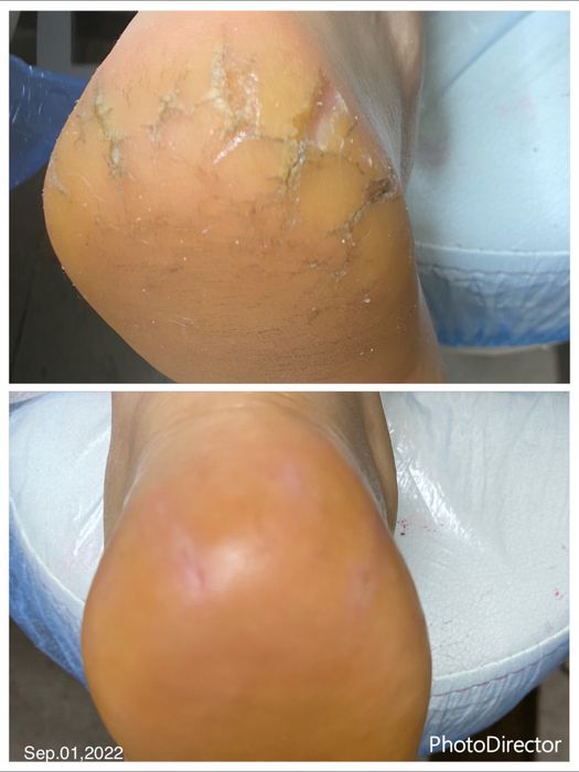 Подолог:Смарт педикюр, маникюр,вросший ноготь