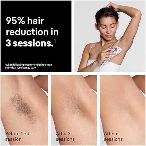 Нов Braun Skin iExpert IPL Фотоепилатор Трайна Епилация Браун PL7442 уред косми