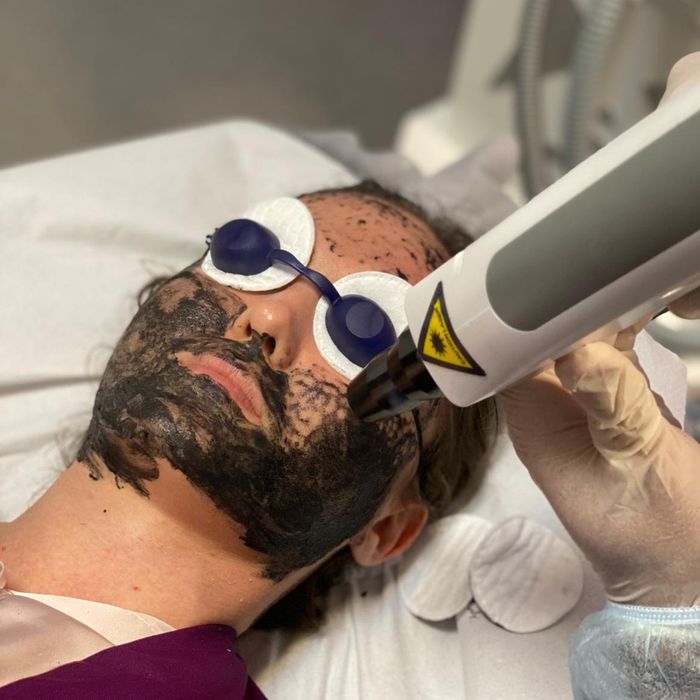 Îndepartare - stergere tatuaje pico laser laser