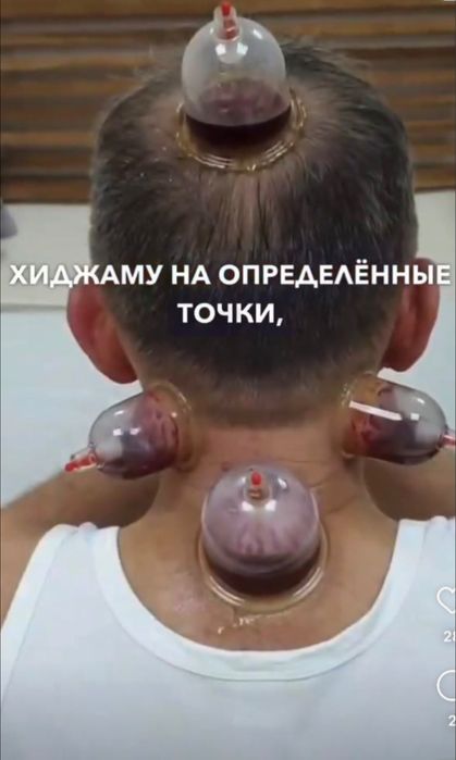 Хиджама в районе 45 квартала